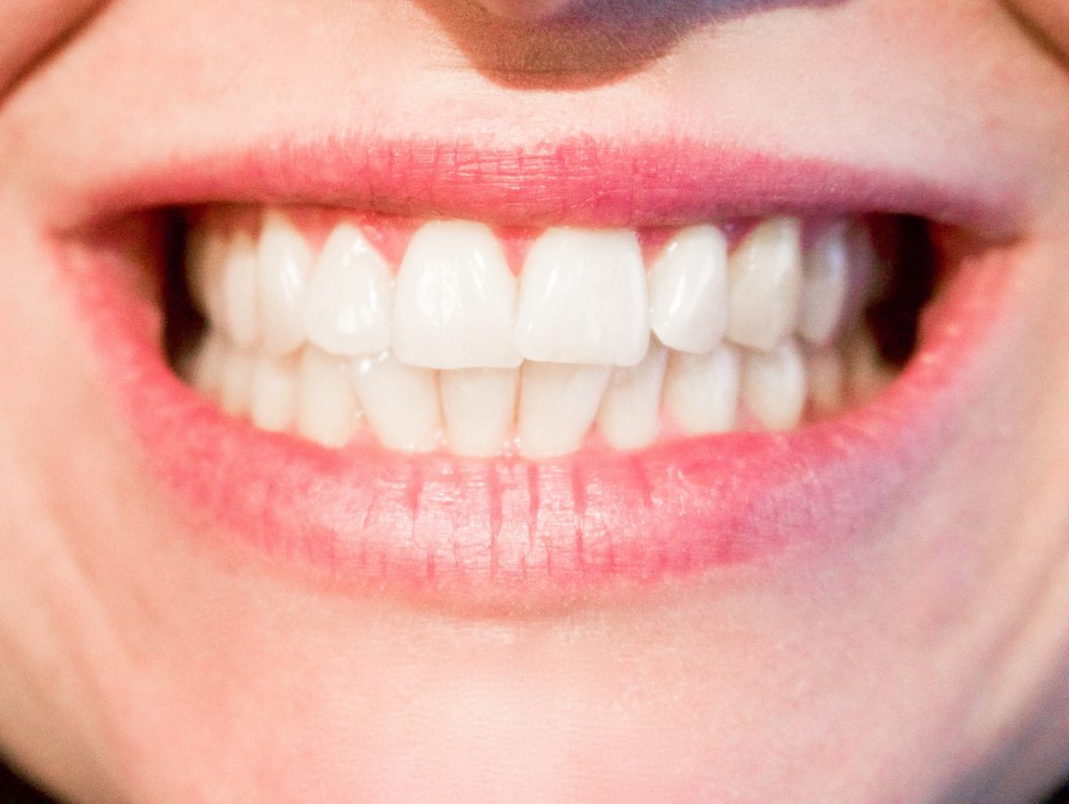Dzisiejsza technika stosowana w salonach stomatologii estetycznej być może spowodować, że odbierzemy ładny uśmiech.